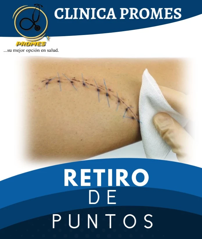 Retiro de Puntos Quirúrgicos